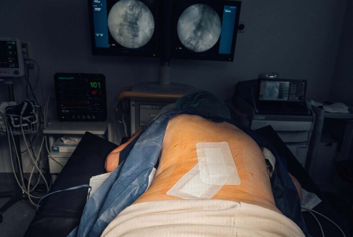 Zona lumbar de un paciente tras un bloqueo guiado por imagen en Clínica Dolentia, con el apósito colocado; al fondo, los monitores de escopia y de constantes que se usan durante el procedimiento